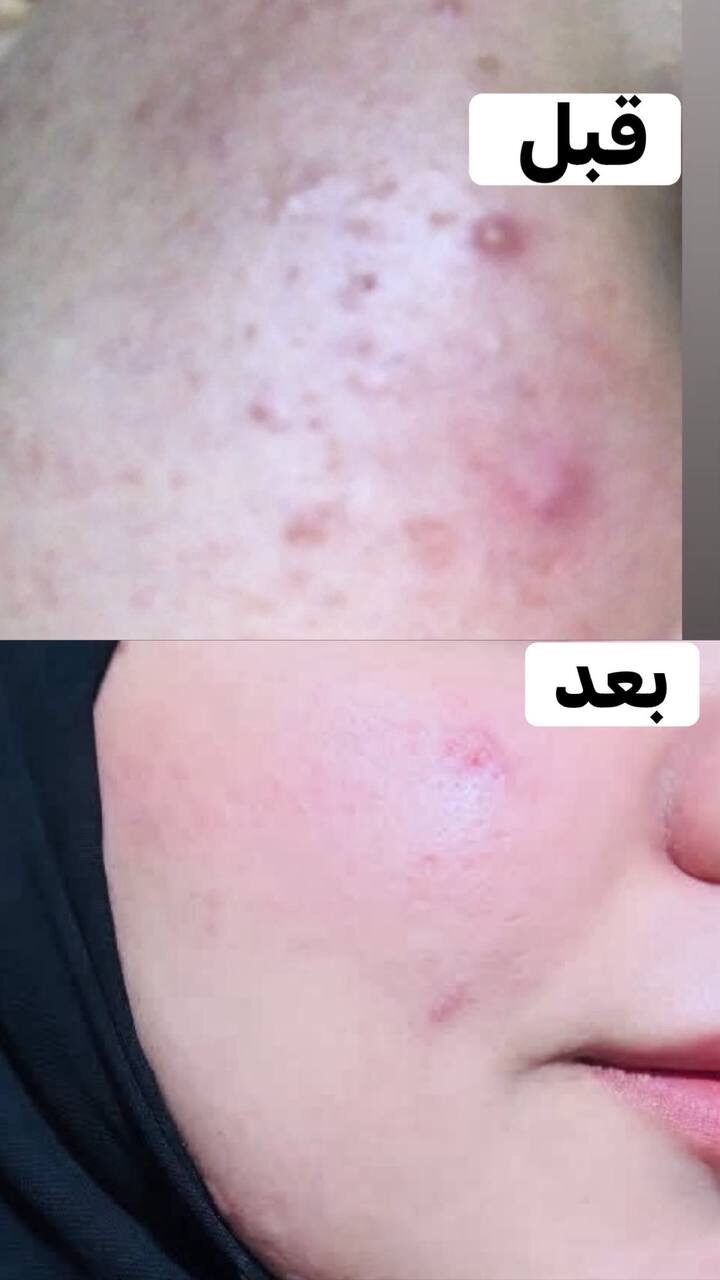 قبل وبعد 4