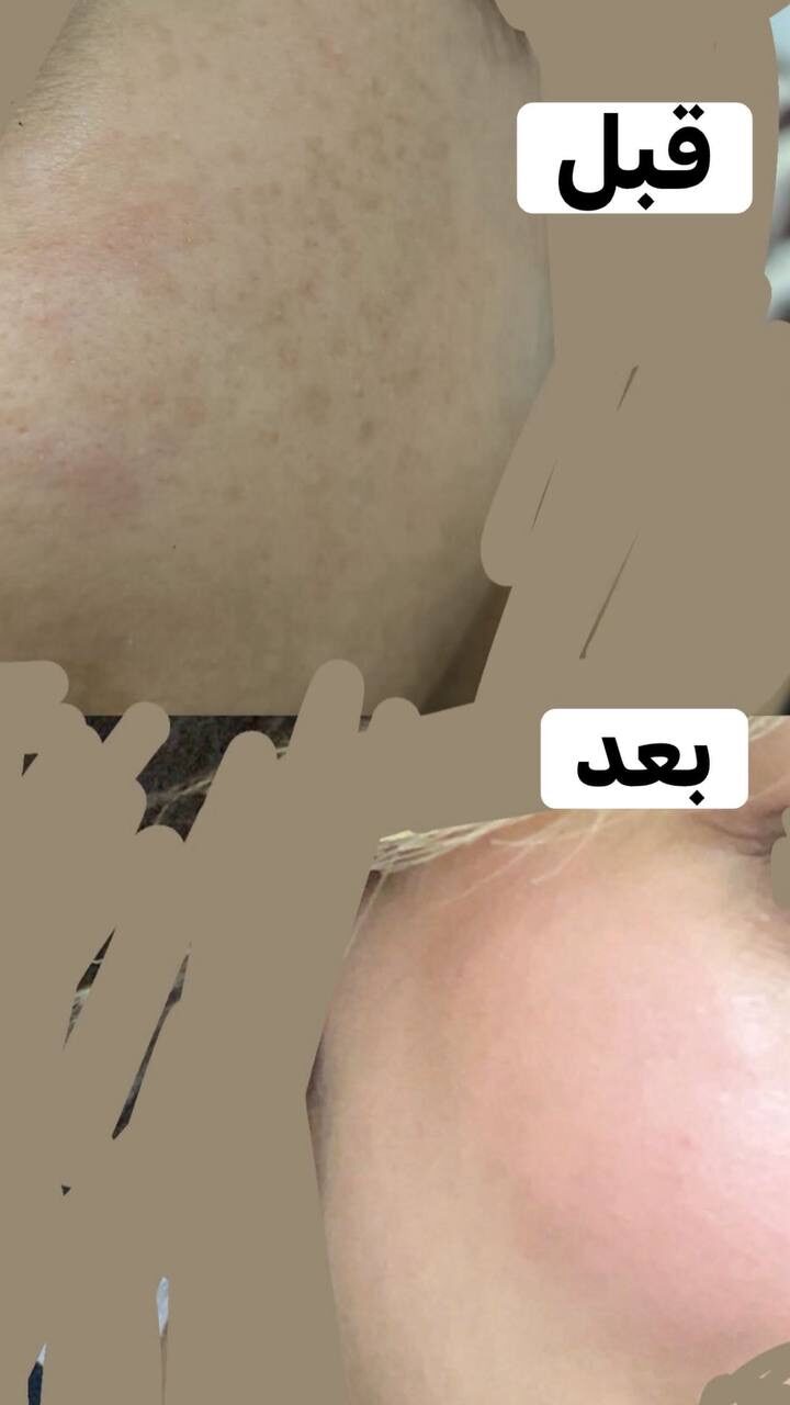 قبل وبعد 3
