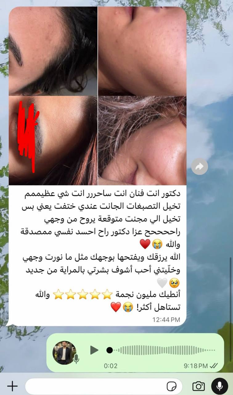 رسالة متابعة رقم 4